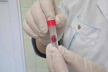 Заболеваемость туберкулезом в регионе почти на треть меньше общероссийского показателя