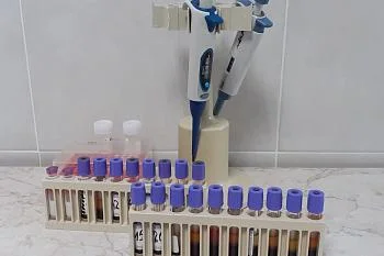 За два месяца более тысячи новорожденных прошли неонатальный скрининг по новой программе